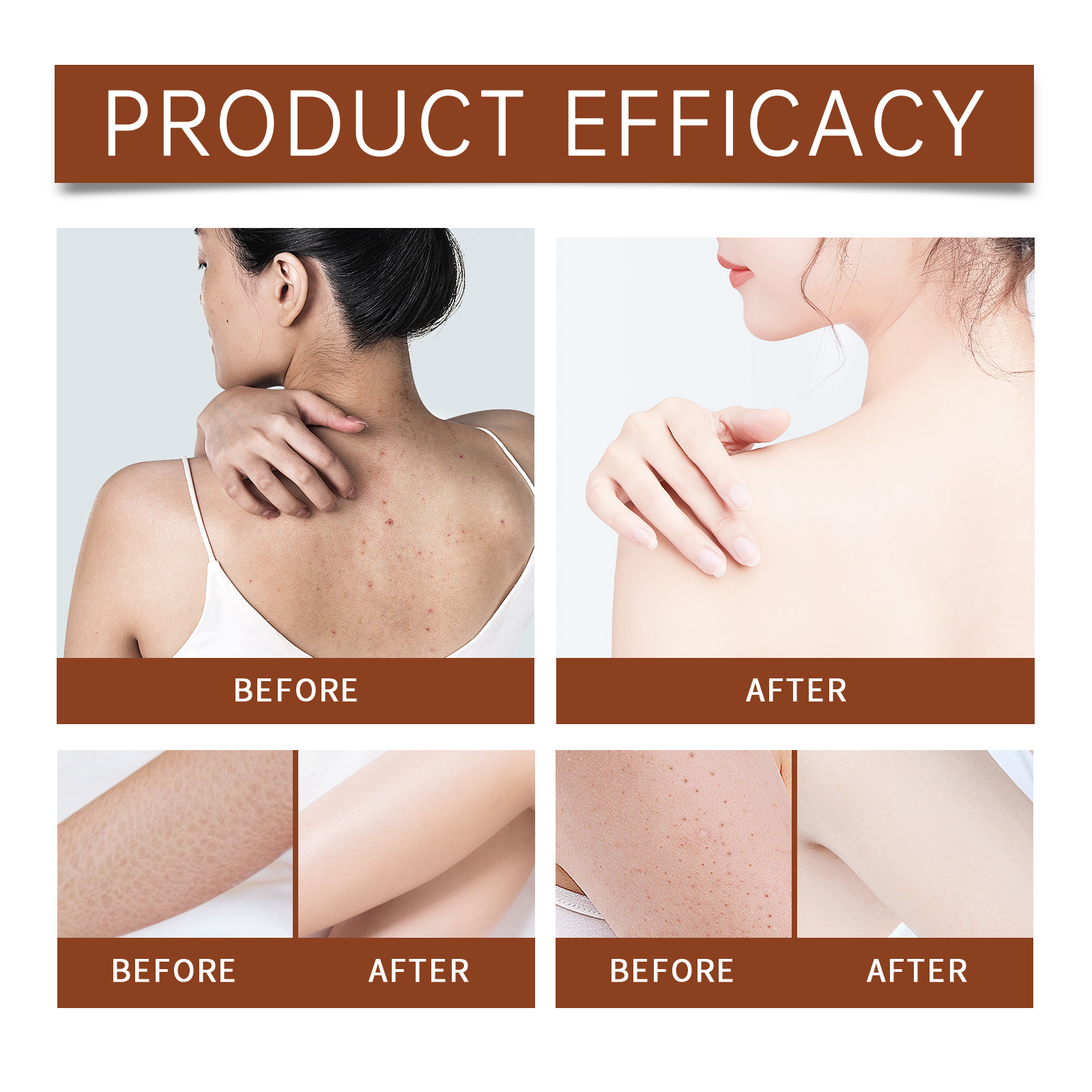 Luxury Body Oil for Dry Skin A - Luxury Skincare Women recensione e prezzo